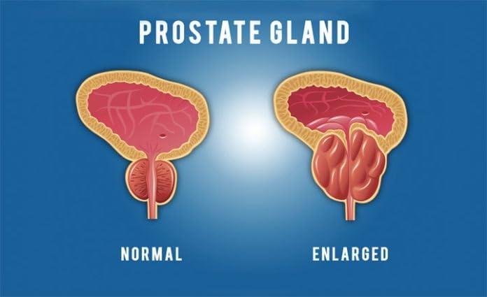 Pulean Formula - Natural Enlarged Prostate Support, Winner of 5 Awards. 240 Tablets