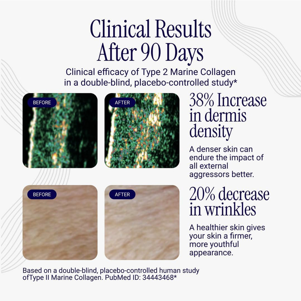 Liposomal Collagen Peptides - High-Absorption Liquid Collagen Supplement - Supports Skin Elasticity, Joint Health, and Overall Vitality for Healthy Aging, 5 fl oz