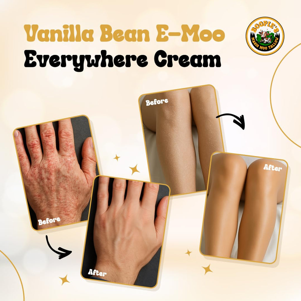 Magic Moo Tallow Vanilla Bean E-Moo Moisturizing Everywhere Cream with Organic Emu Oil. For acne, stretch marks, eczema, hyrdation, dry skin & more. 2oz