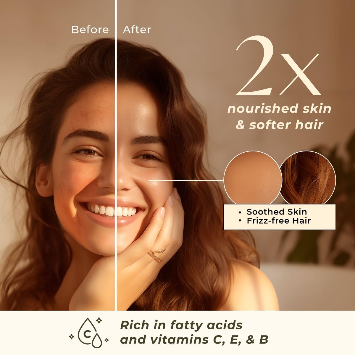 Gya Labs Organic Rosehip Oil for Face - 100% Pure Natural Vegan Rosehip Seed Carrier Oil for Skin, Hair & Body (1 Fl Oz)