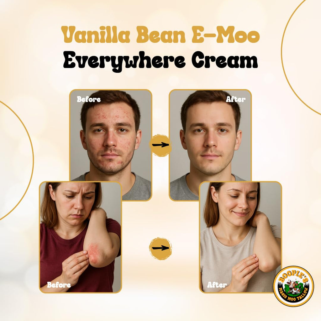 Magic Moo Tallow Vanilla Bean E-Moo Moisturizing Everywhere Cream with Organic Emu Oil. For acne, stretch marks, eczema, hyrdation, dry skin & more. 2oz