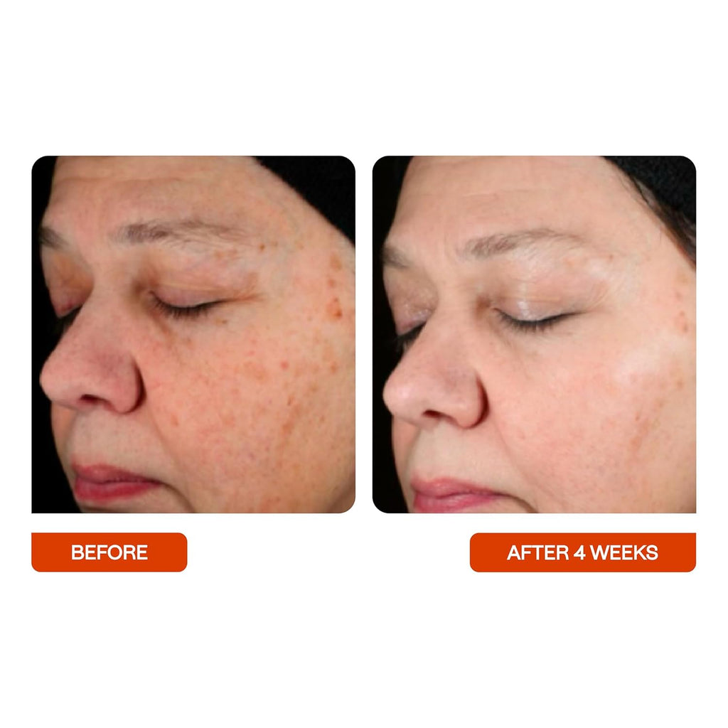 BeautyStat Universal C Refiner - Made in the USA - 20% Pure Vitamin C Serum For Face - Clinically Tested to Decrease the Look of Fine Lines and Wrinkles and Improve Firm Skin Tones - 1oz, 30ml