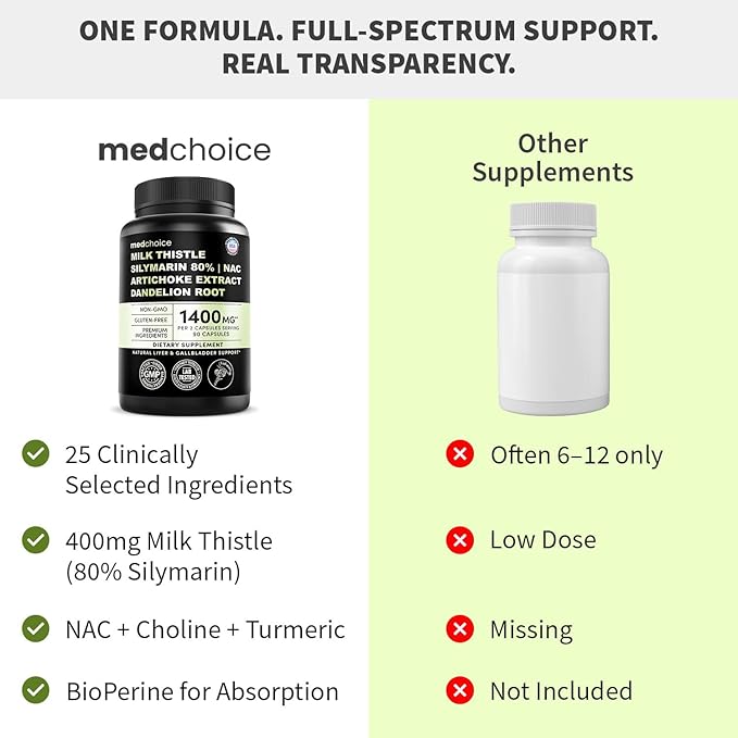 Milk Thistle Supplement w/ NAC, Artichoke & Dandelion – Liver Support Supplement & Gallbladder Supplements in One – Liver Detox – Milk Thistle & Liver Care Supplements – 90 Vegan Capsules, (Pack of 4)