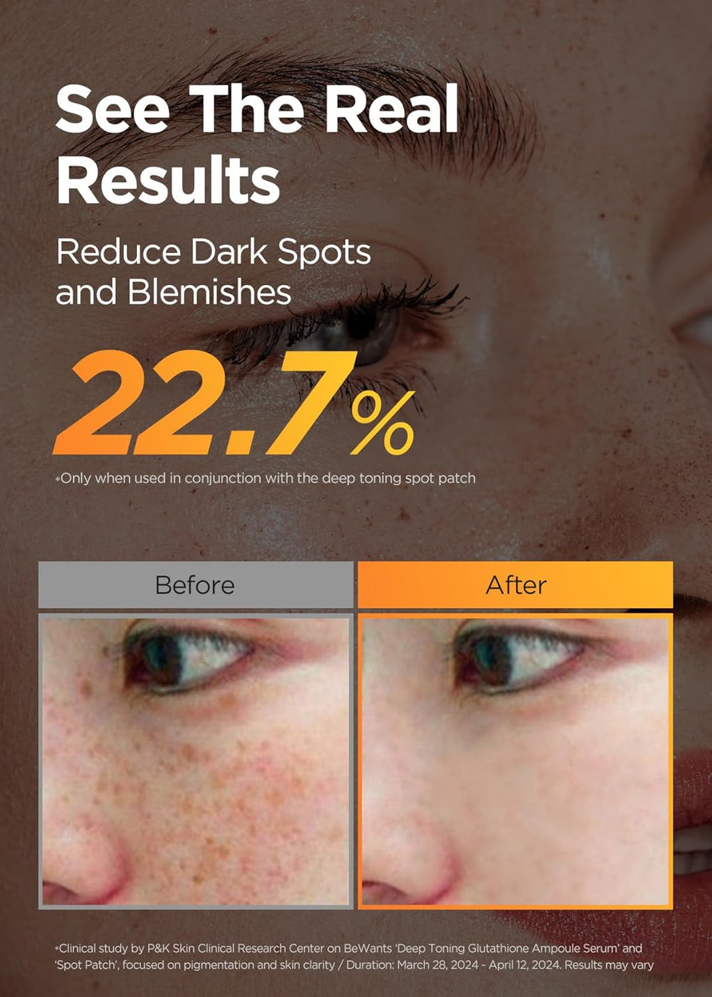 Bewants Skin Brightening Glutathione Serum, Deep Toning Complex for Even Skin Tone, with Vitamin C, Niacinamide 50,000ppm, and Dark Spot care, 1.01 fl oz (1 Pack)