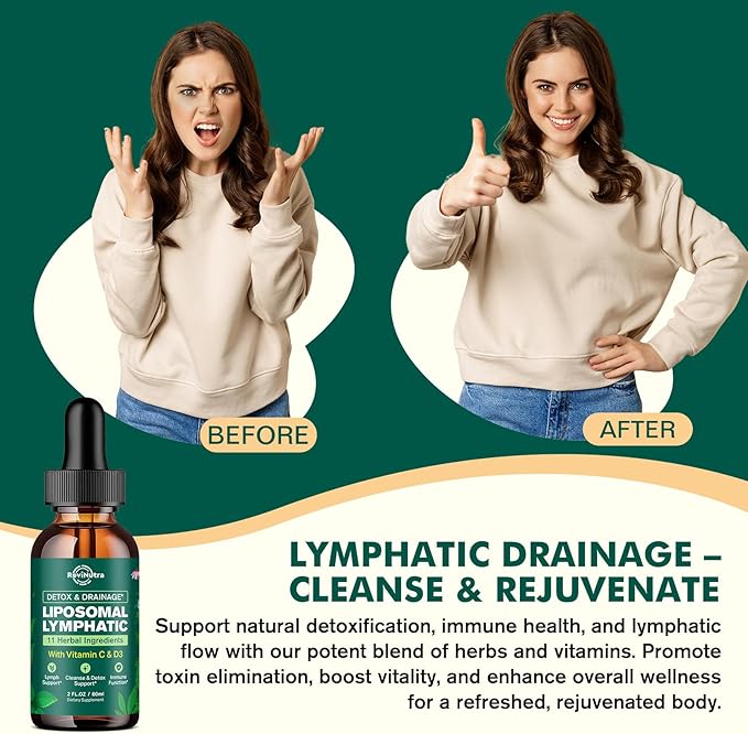 Liposomal Lymphatic Drainage Liquid Drops - Lymphatic Support Supplement with Dandelion Root, Cleavers, Echinacea, Calendula for Immune, Detox Cleanse, Lymph System Support, Lemon Flavor, 2 Fl Oz