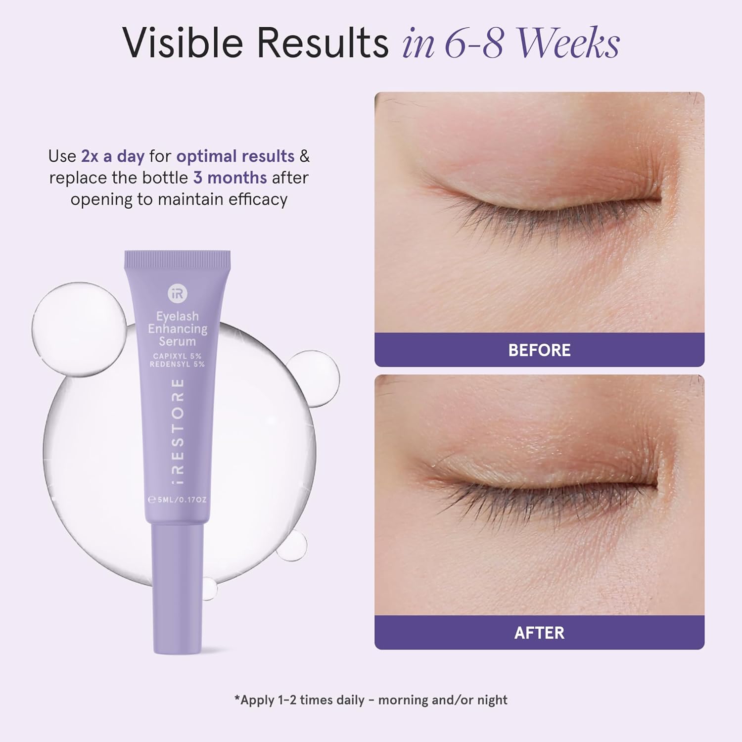 iRESTORE Eyelash Growth Serum | Vegan Prostaglandin Free & Non Irritating | For Thicker, Fuller, Longer and Gorgeous Eye Lashes | Lash Enhancing Serum | 3 Month Supply 5ml