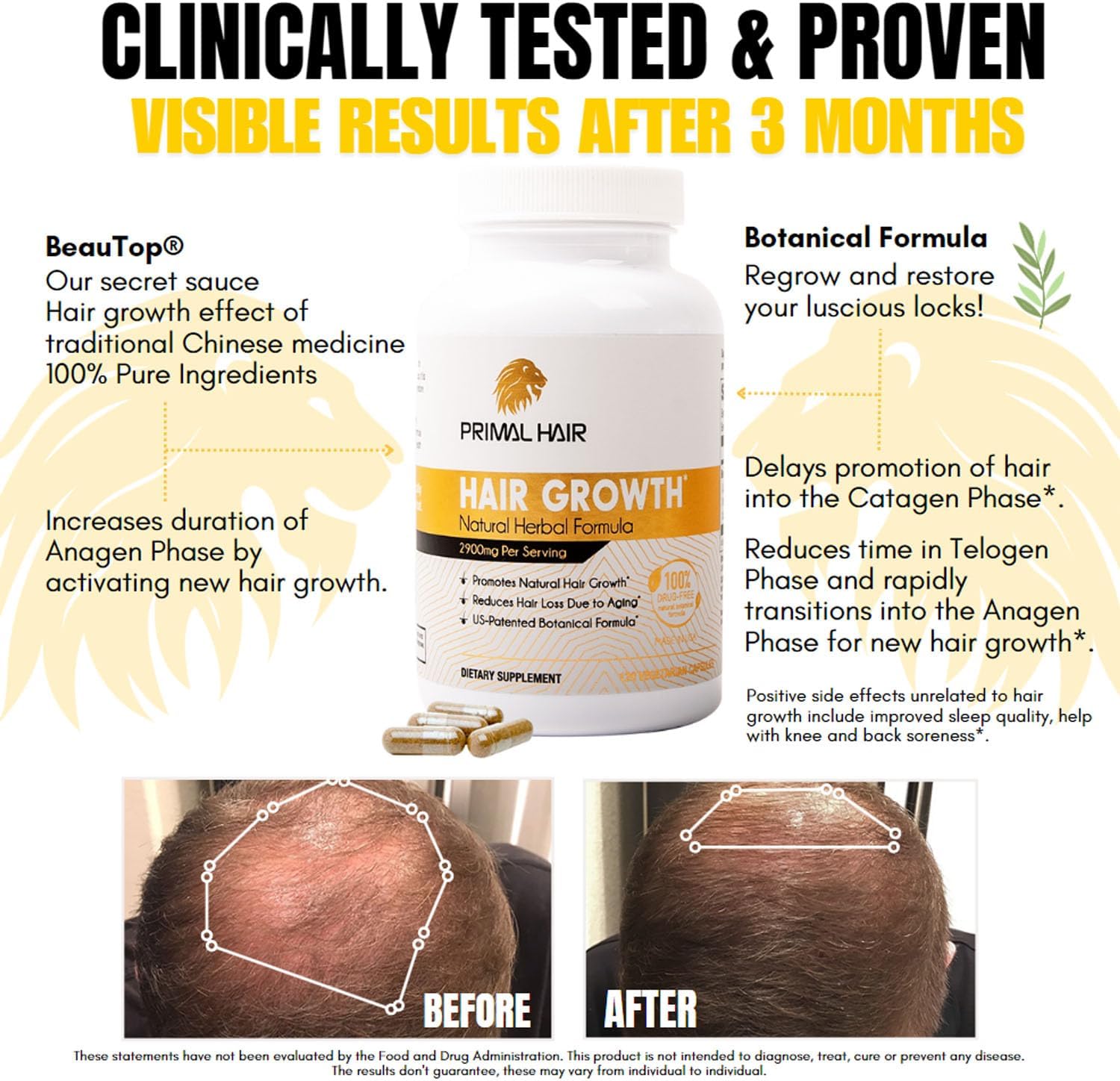 3 PK- 100% Natural Growth Treatment, Reduces Hair Loss, US Patented Formula Proven Effective for Men & Women, 100% Vegan, Non-GMO, 90-Day Supply, 3 Pack
