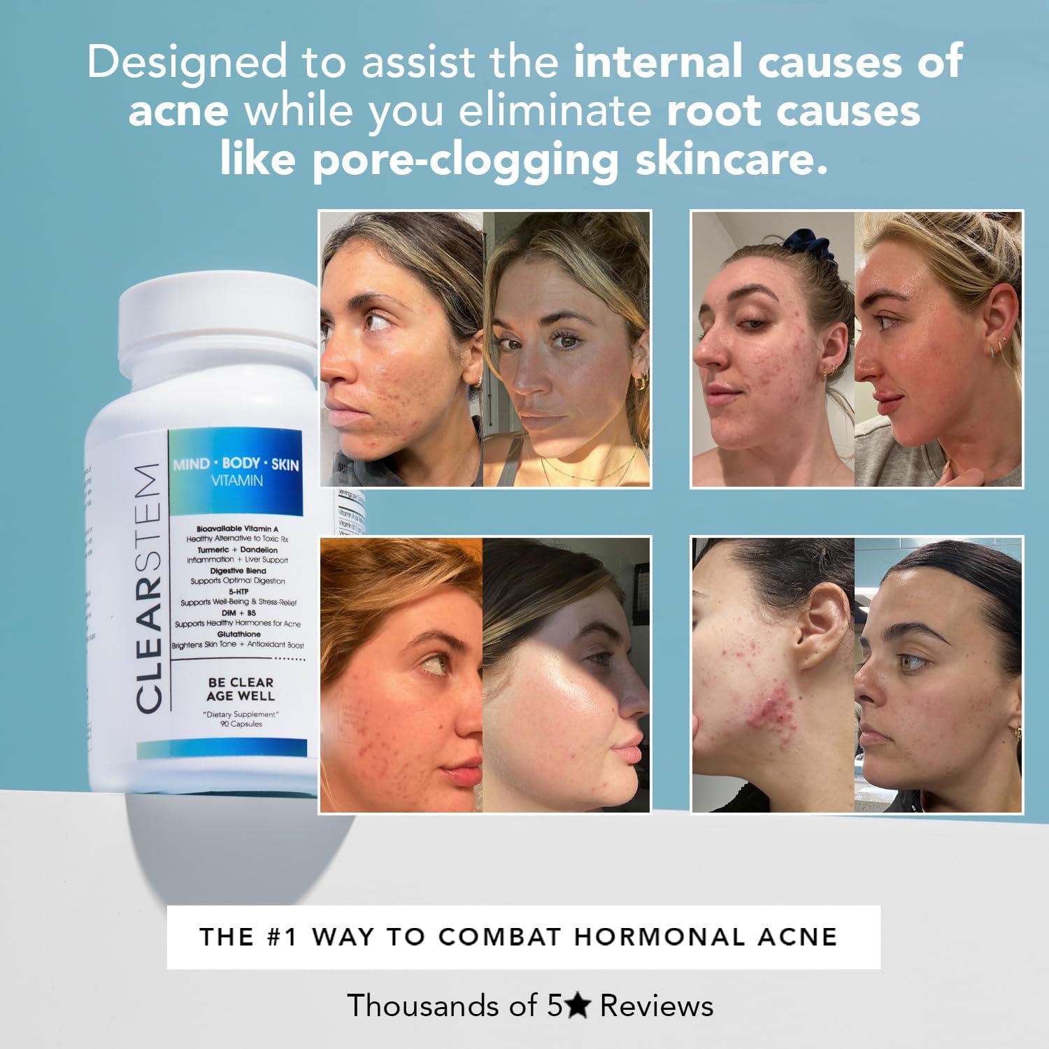 CLEARSTEM - MINDBODYSKIN Hormonal Acne Supplement (5-HTP) - Natural DIM Supplement - Skin Care Vitamins - Hormone Balance, Antioxidants - Gluten Free, Cruelty Free - 60 Servings, 180 Capsules