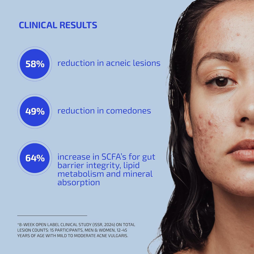 Codex Labs Shaant Clear Skin Supplement – 60 Vegan Capsules | Acne Probiotics with 9-Strain Blend, Green Tea EGCG & Guggul – Daily Support for Acne-Prone Skin & Clear Complexion