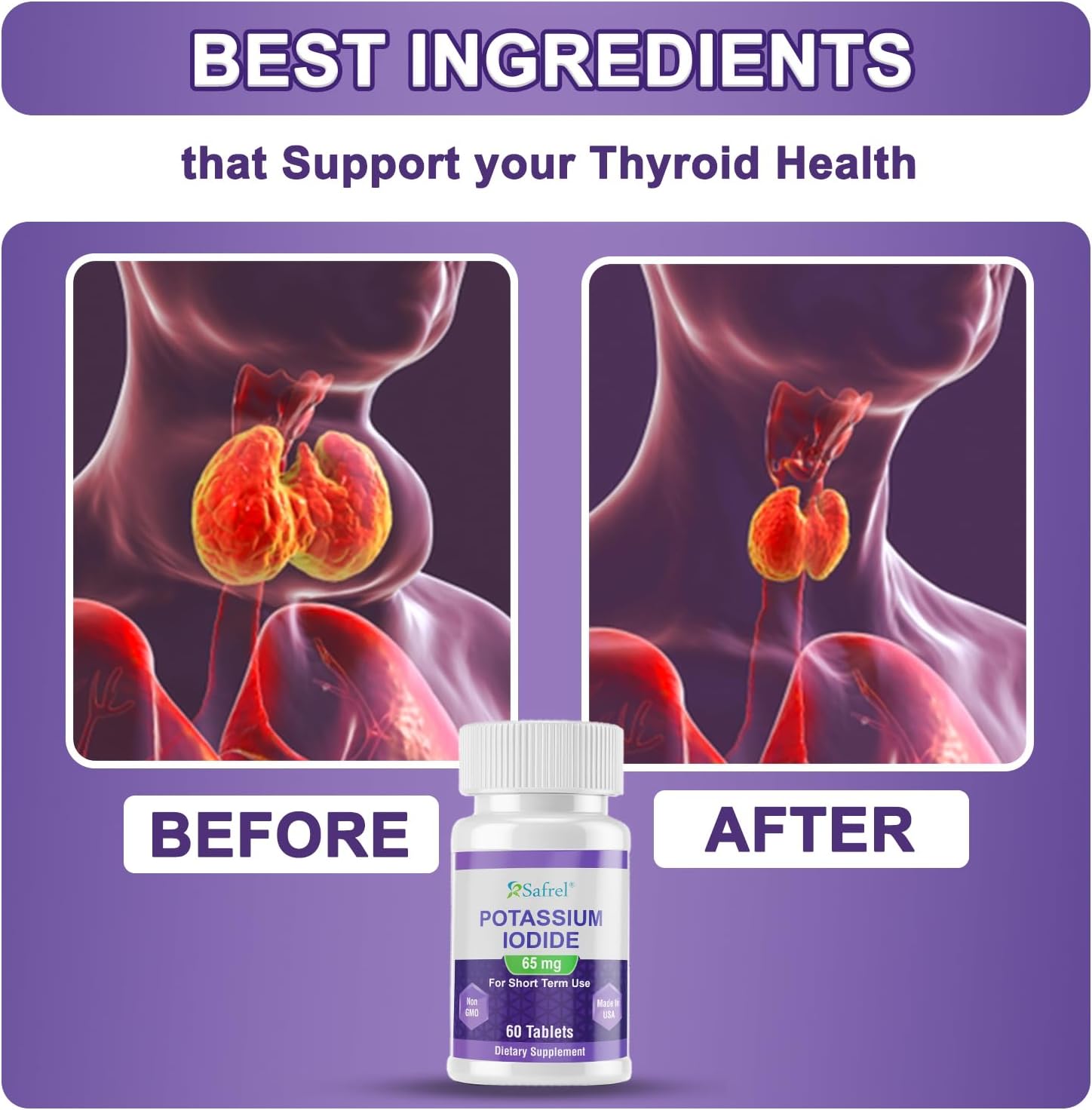 Potassium Iodide 65 mg Tablets per Serving