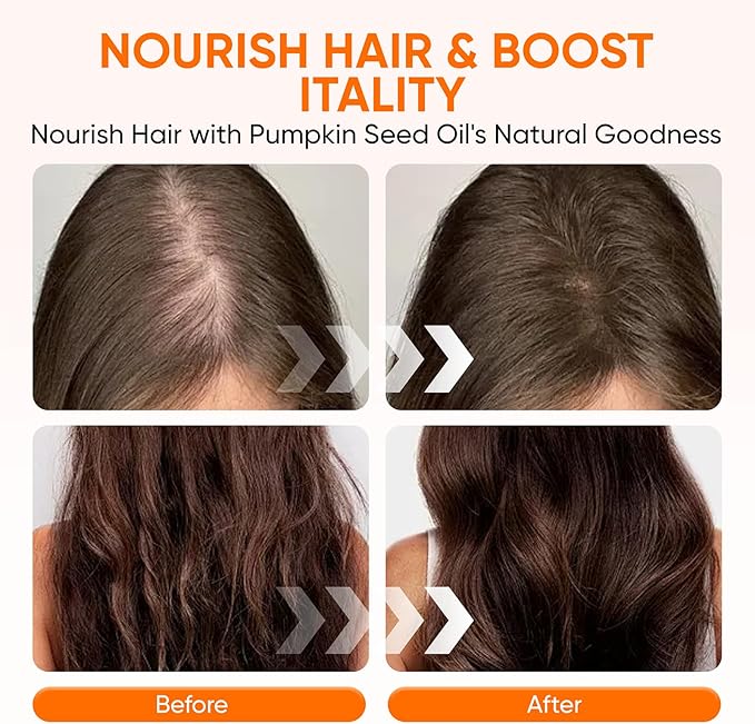 Pumpkin Seed Oil Capsules, 2 in 1 Pumpkin Seed Oil with Saw Palmetto for Hair, 3000mg Pure & Natural Supplement, Supports Hair Heart Skin Supplement, Non-GMO, Gluten Free, 300 Softgels (1)