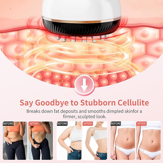 Lymphatic Drainage Massager & Anti Cellulite Massage Tool,New Lymphatic Massager,Helps Reduce Stretch Marks & Cellulite，for Belly, Arms & Legs,Body Sculpting Machine with Heat & Vibration