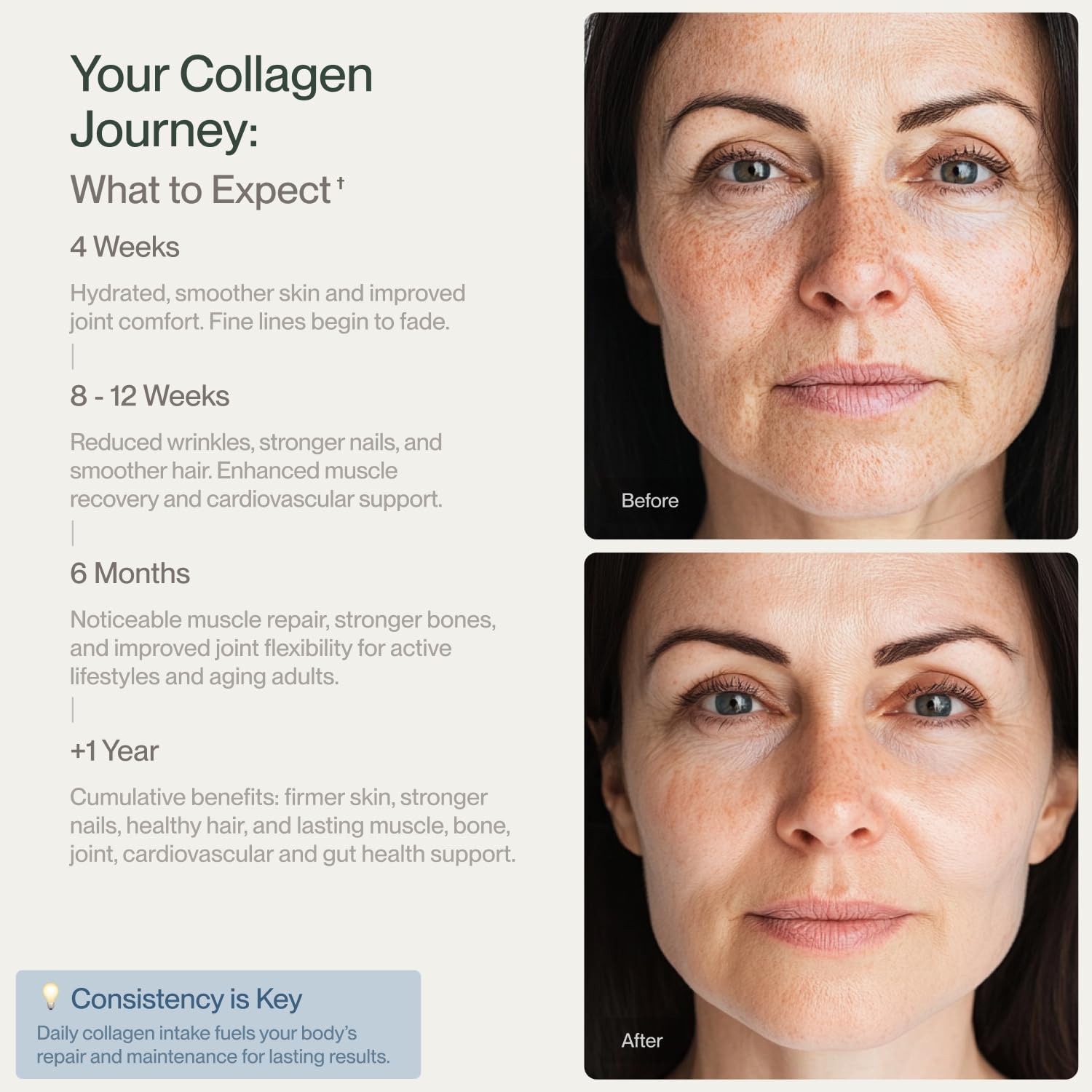 Collagen Peptides Powder Grass-Fed Pasture-Raised Hydrolyzed Collagen Powder, Type I & III Hair, Nails, Skin and Joints, Non-GMO, Paleo & Keto, Unflavored, 16 Fl oz. 45 Servings