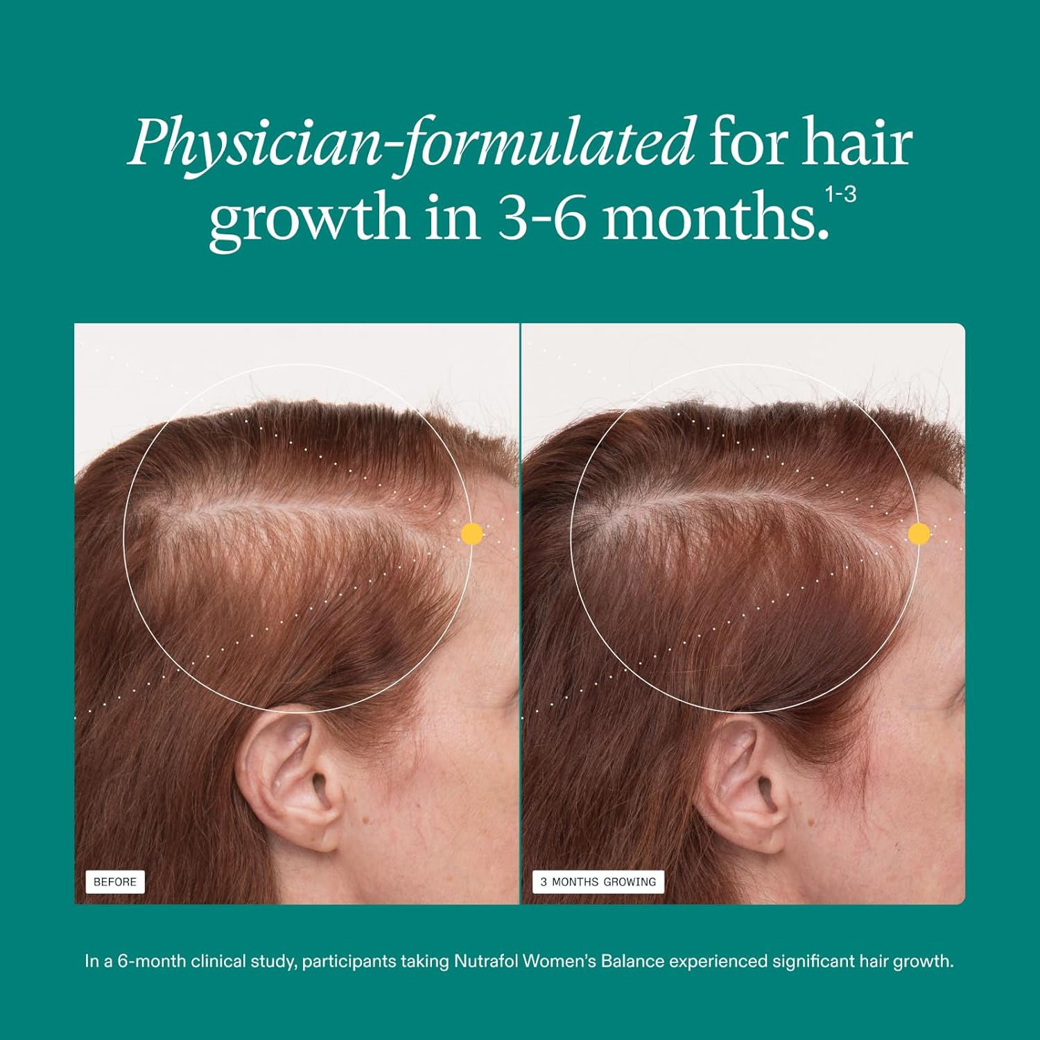 Nutrafol Women's Balance Hair Growth Supplements, for Women 45 Years and Older, Clinically Proven for Visibly Thicker Hair and Scalp Coverage, Dermatologist Recommended - 3 Month Supply, Pack of 3
