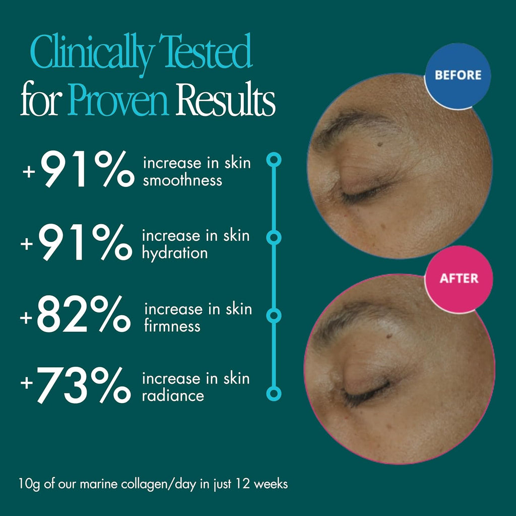ENSANTE Clinically Backed Premium Marine Collagen Peptides Powder Unflavored, Type I II III IV Collagen for Skin Hair Nail Joint, Wild Deep Sea Collagen with Organic Camu Camu Vitamin C, Lab Tested