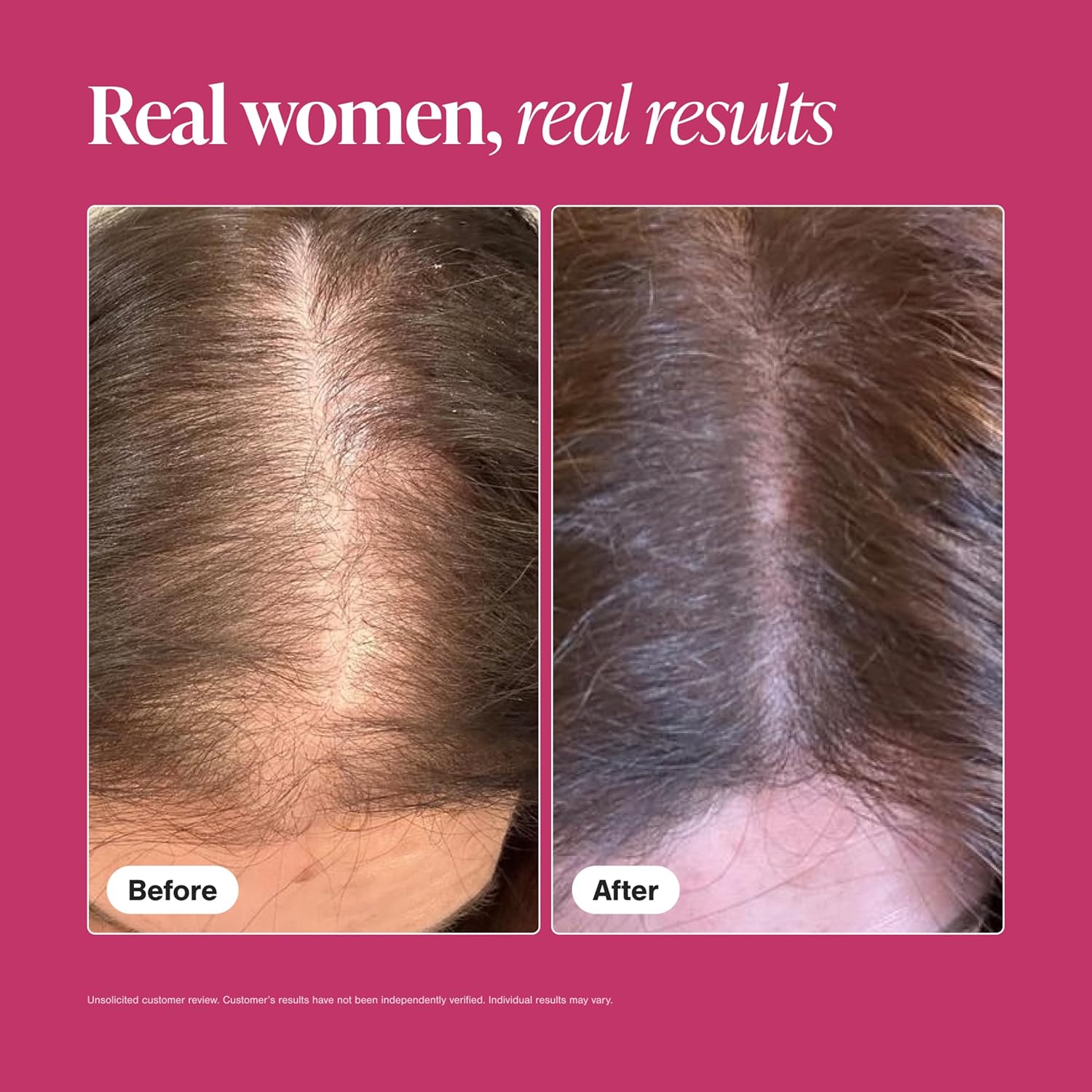 Viviscal Hair Growth Supplements For Women For Thicker, Fuller Hair, Nourishes Thinning & Loss, With Proprietary Collagen Complex, 60 Tablets, 1 Month Supply