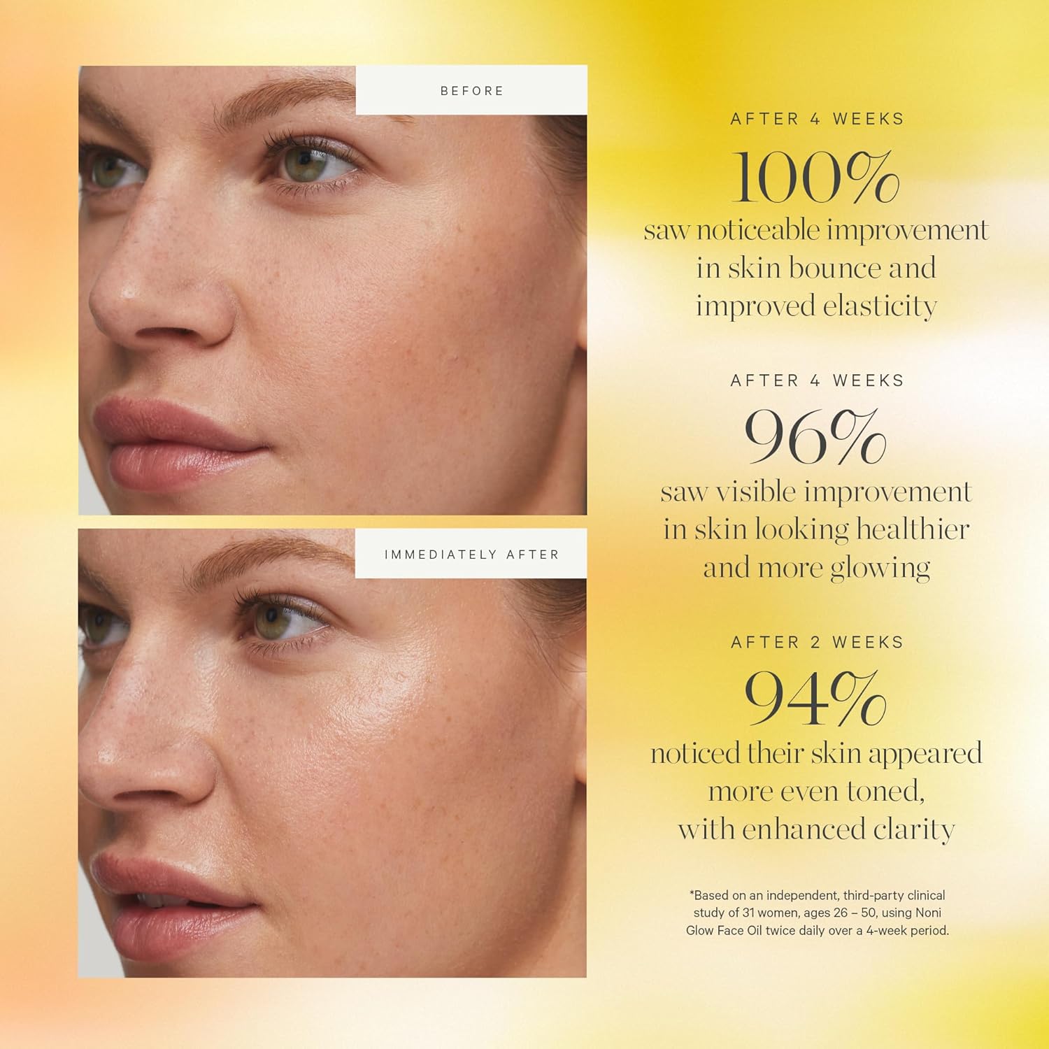 KORA Organics Noni Glow Hydrating Face Oil for Women with Rosehip, Gua Sha Oil, Certified Organic, Cruelty Free, 1.69 fl oz