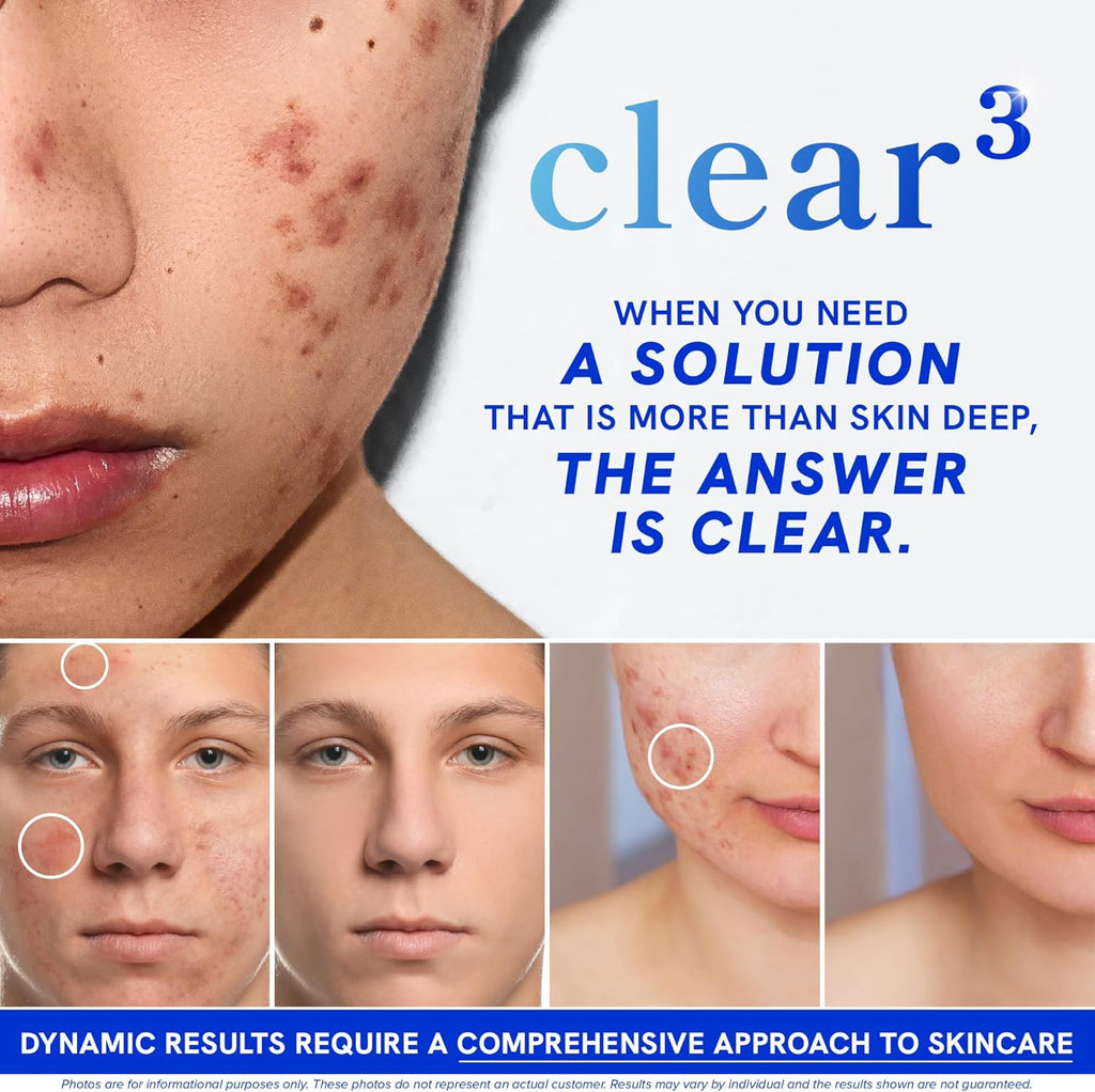 Clear Skin Acne Supplement with Zinc, DIM & Probiotics | 3-in-1 Balance, Clarify, Restore Support with Hyaluronic Acid & Skin Support Vitamins | for Women & Men | Oral Hormonal Acne Pills | 60 Ct