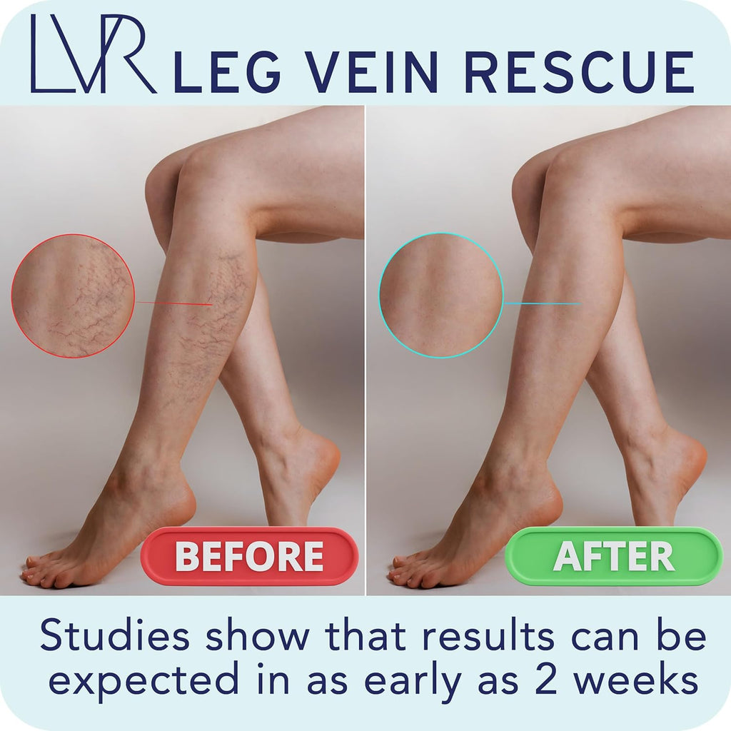 Clinically Studied Diosmin Varicose Vein and Leg Circulation Support 90 Day Supply - Spider Veins & Leg Edema Relief Citrus Bioflavonoids Natural Health Supplement (90 Capsules)