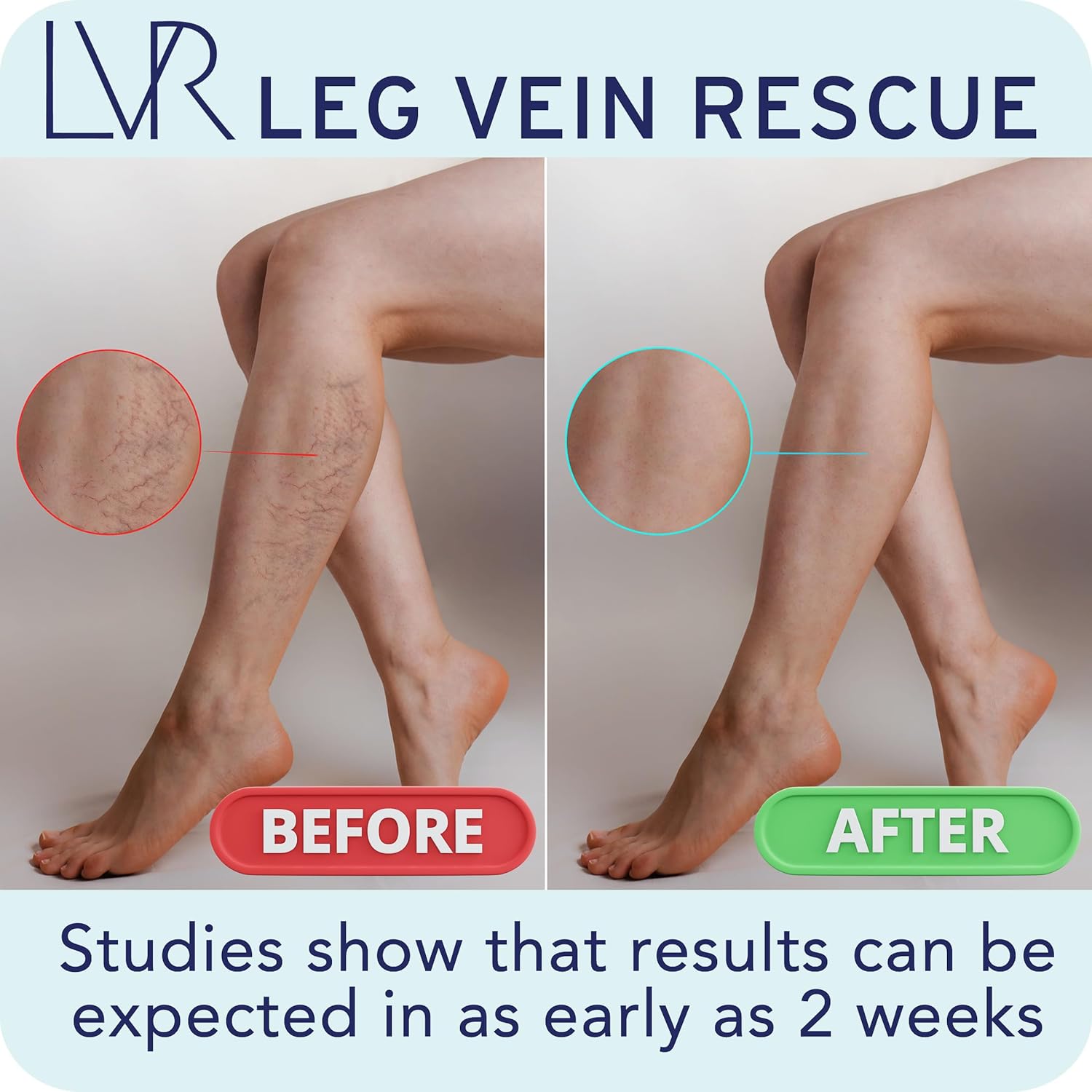 Clinically Studied Diosmin Varicose Vein and Leg Circulation Support 120 Day Supply - Spider Veins & Leg Edema Relief Citrus Bioflavonoids Natural Health Supplement (6 Bottles)