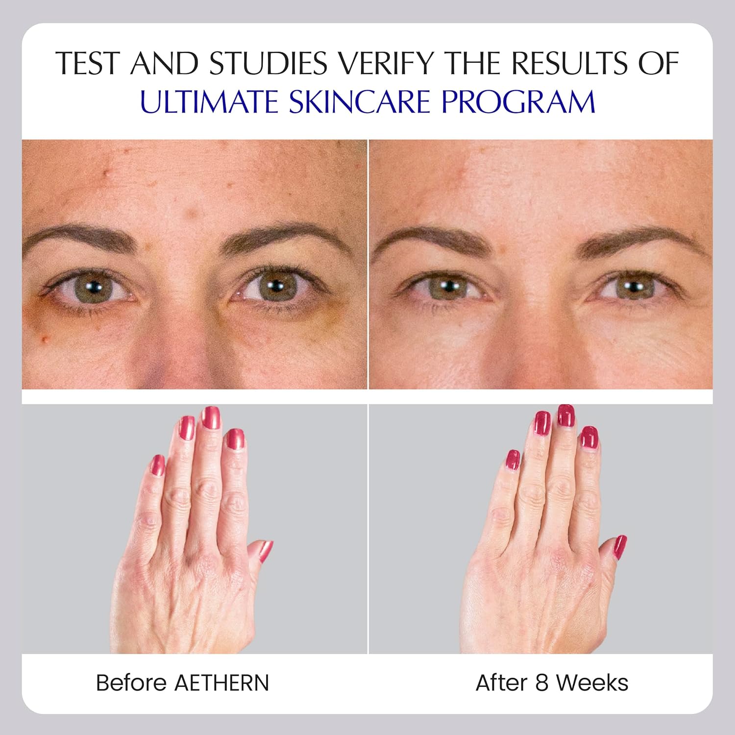 Liquid Skin Care Supplement with Collagen + Hyaluronic Acid. Ready-to-Drink. Clinically Proven for Glowing, Hydrated, and Firm Derma. UV Protection. 28 Servings. Ultimate Skincare Program