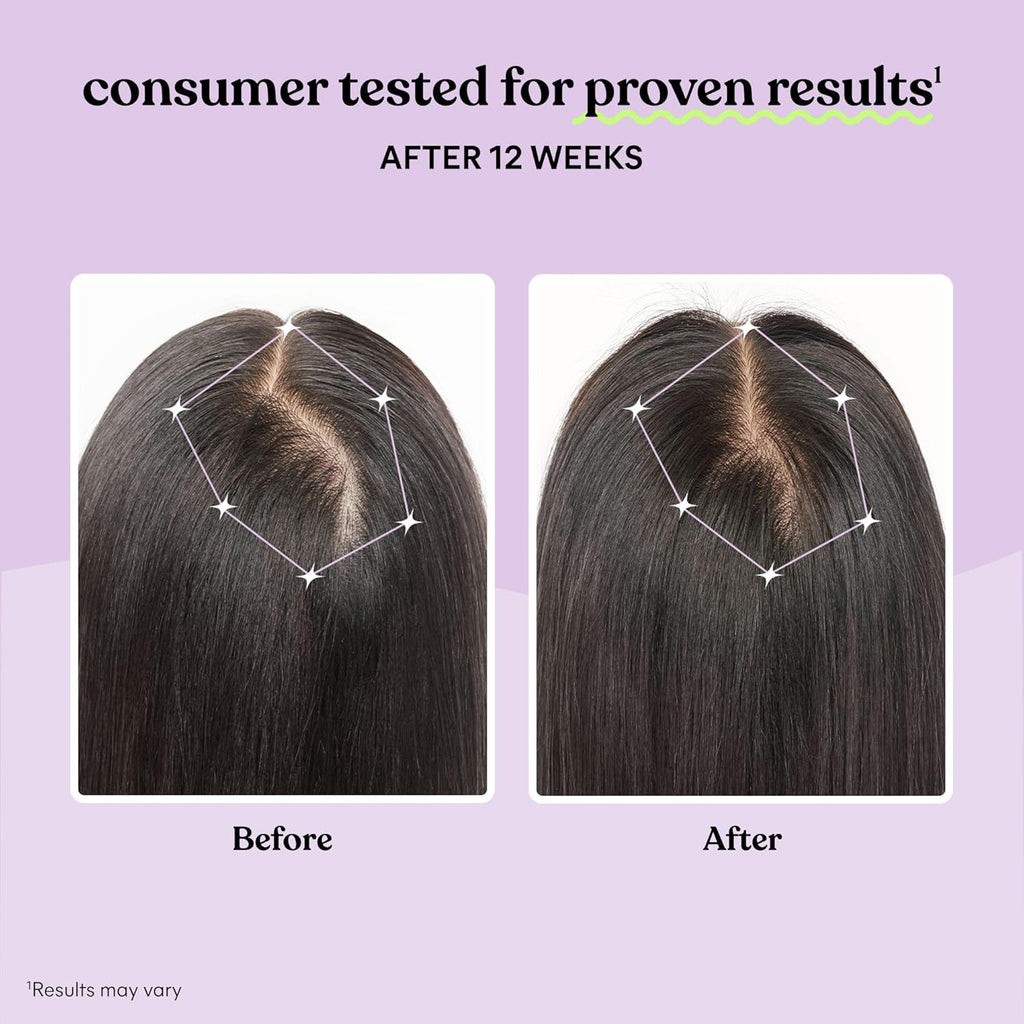 Lemme Grow Hair Growth Supplement for Women, Clinically Proven Keratin Complex for Visibly Thicker Hair and Scalp Coverage, Reduced Shedding, Nourish Thinning Hair - 1 Month Supply