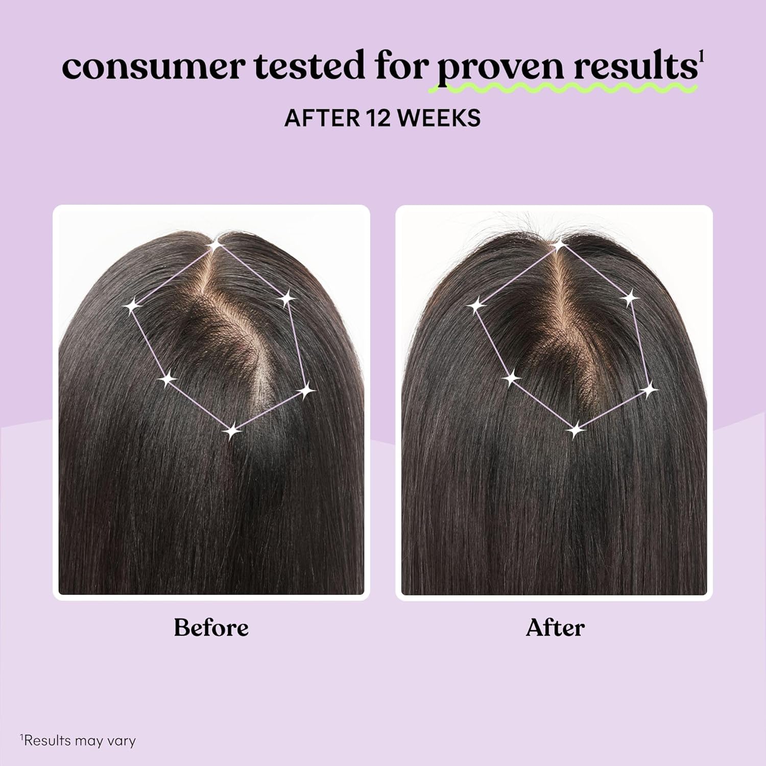 Lemme Grow Hair Growth Supplement for Women, Clinically Proven Keratin Complex for Visibly Thicker Hair and Scalp Coverage, Reduced Shedding, Nourish Thinning Hair - 1 Month Supply