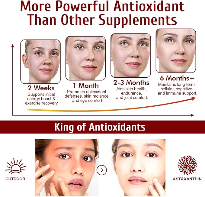Astaxanthin Supplements 12mg 120 Softgels,Premium Astaxanthin Antioxidant Supplements,Triple Strength Skin Vitamins with Antioxidant Activity,Supports Eye, Joint, Brain, Heart & Immune System (1) (1)