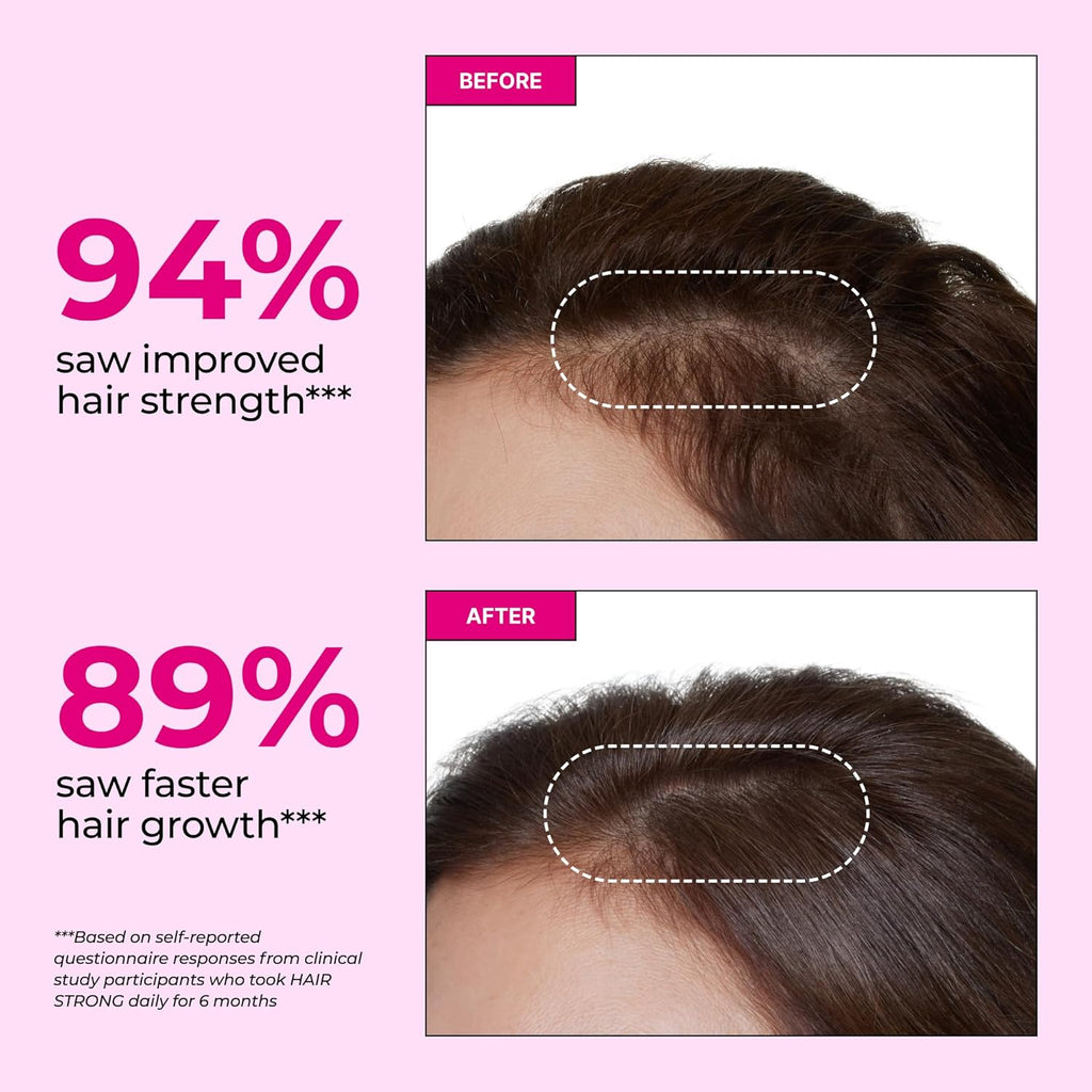 HUM Hair Strong - Hair Growth Vitamins with Biotin, Zinc, and Fo-Ti for Healthy Hair, Skin & Nails - Vegan Hair Supplement for Women | Biotin Supplement, (30 Capsules)