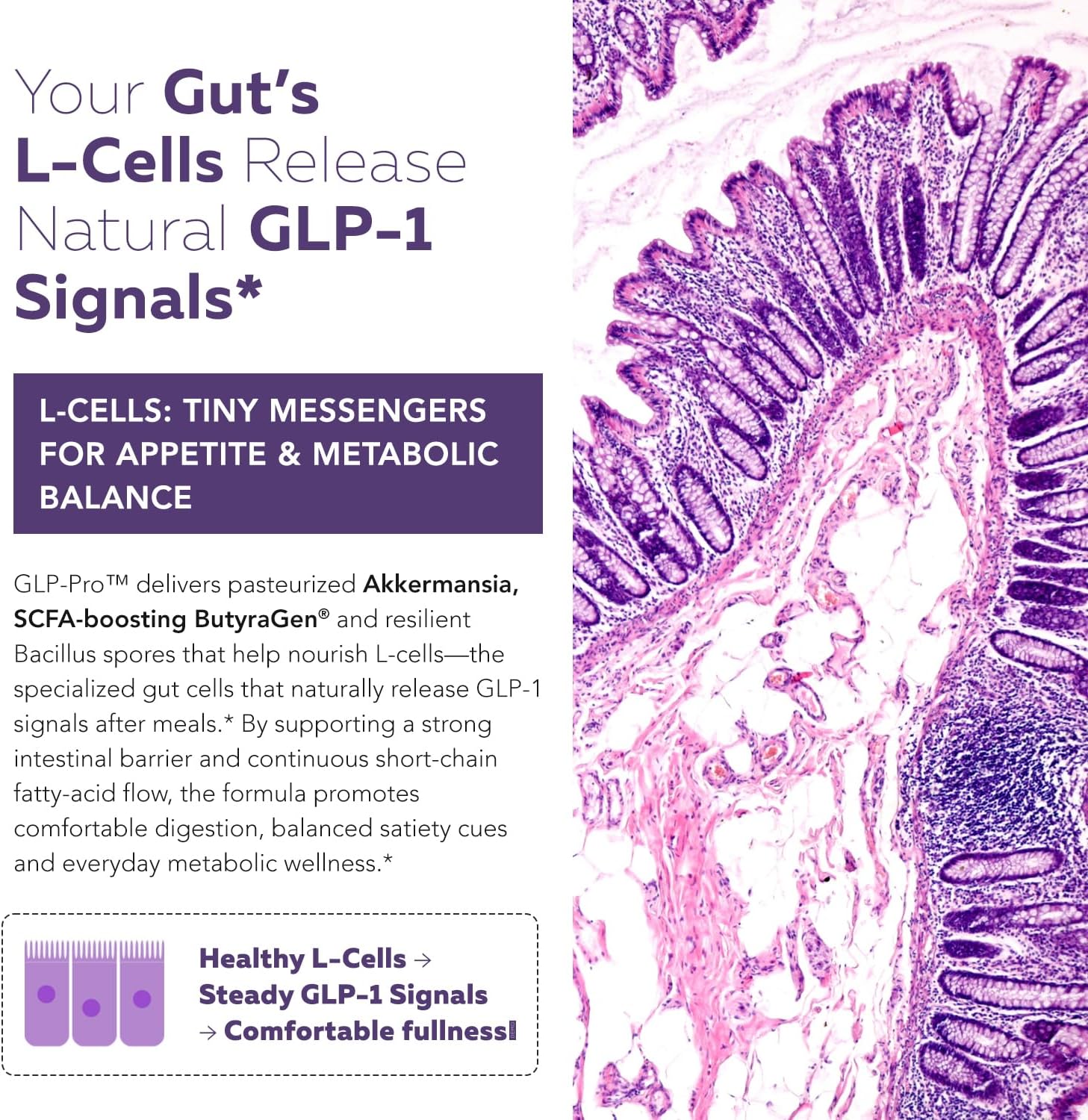 GLP-Pro™: Probiotic & Postbiotic Blend for Natural GLP-1 Support — Akkermansia MucT™, ButyraGen® Butyrate Generator & Spore Bacillus — Healthy Appetite, SCFA & Metabolic Balance — 30 Count