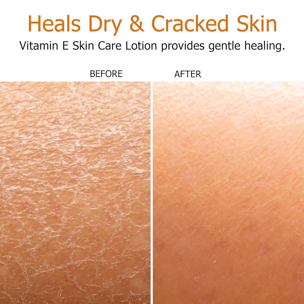 Fruit of the Earth Vitamin E Lotion 16 oz (3 Pack)