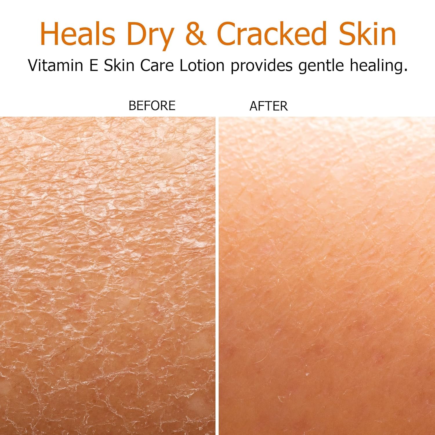 Fruit of the Earth Vitamin E Lotion 16 oz (3 Pack)