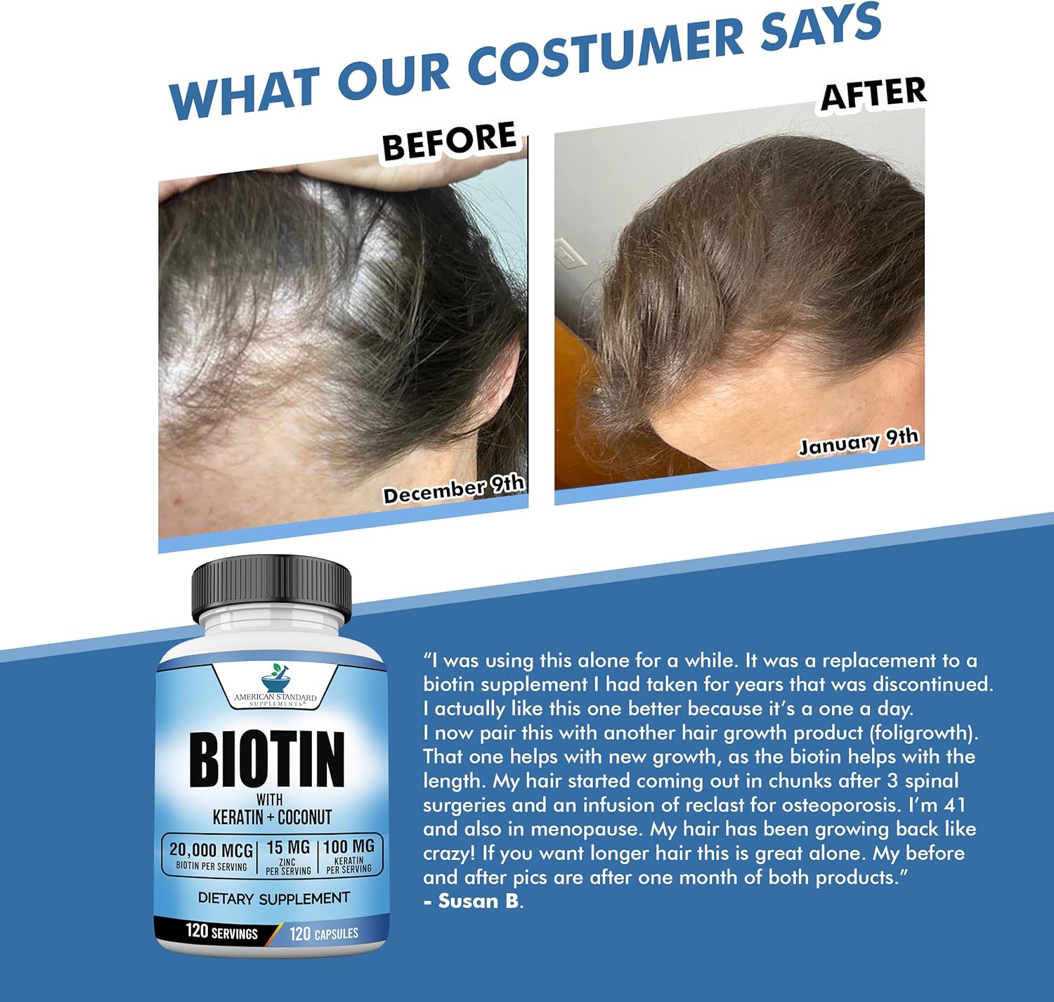 Biotin 20,000mcg with Keratin, Coconut Powder and Zinc, Hair Growth Supplements, Biotin Supplements, Healthy Hair Skin & Nails for Adults,120 Veggie Capsules, 120 Day Supply